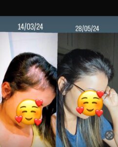 LONG BEAUTY I Prova Social 19