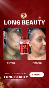 LONG BEAUTY I Prova Social 21