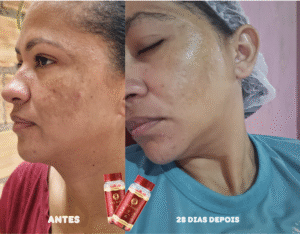 LONG BEAUTY I Prova Social 25